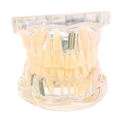 Modelo anatómico de dientes - H139074  - HeineScientific® - para odontología / de mandíbula / para odontología