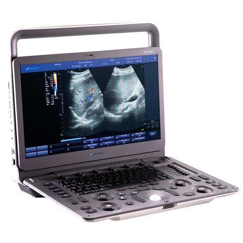 Ecógrafo portátil - DUS – 5000 + - Advanced Instrumentations - para ecografía ginecológica y obstétrica / para ecografías abdominales y pélvicas / para ecografía cardiovascular
