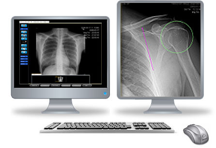 PACS para imágenes médicas - Clarity  - iCRco - médico
