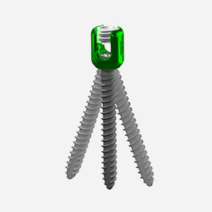 Tornillo pedicular para vértebra lumbar - Genoss - poliaxial / metálico