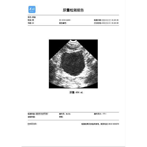 Software de impresión - Mianyang Meike Electronic Equipment - de seguridad / de verificación / urología