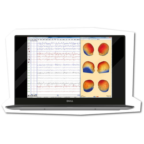 Software médico - BESA - Brainbox - para EEG / para la investigación / de análisis
