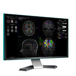 Software médico - nordicBrainEx - NordicNeuroLab - para IRM / para MRI functional / de análisis