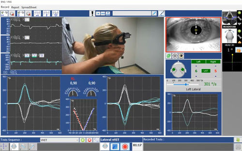 Software de prueba - Instrumentation DIFRA - rehabilitación vestibular