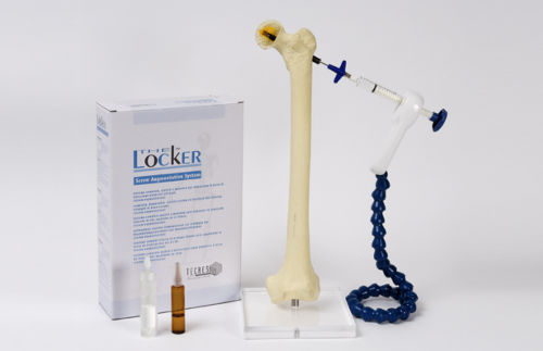 Kit de instrumentos para la inyección de cemento óseo - Locker - Tecres - desechable