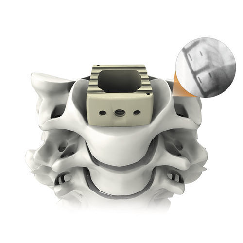 Caja intersomática cervical - PLATEAU®-C - Life Spine - vía anterior / de PEEK