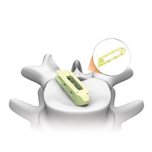 Caja intersomática lumbar - PLATEAU®-LO - Life Spine - vía transforaminal / vía oblicua