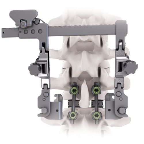 Retractor para cirugía ortopédica - CALYPSO™ - Life Spine