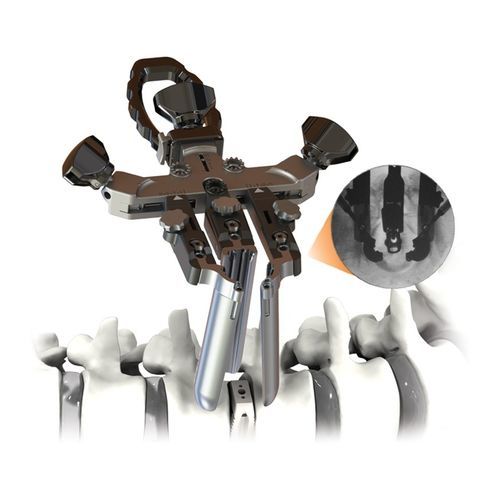 Retractor para cirugía ortopédica - CENTRIC® - Life Spine - de anatomía
