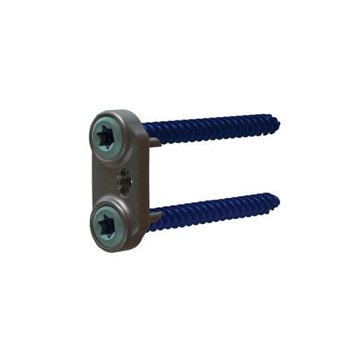 Placa de compresión toracolumbar - SENTRY® 2 - Life Spine - lateral / bloqueada / metálica