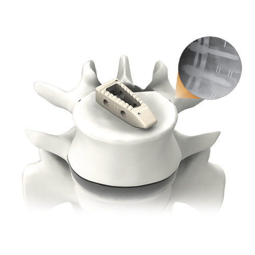 Caja intersomática toracolumbar - PLATEAU®-P - Life Spine - vía posterior / de PEEK