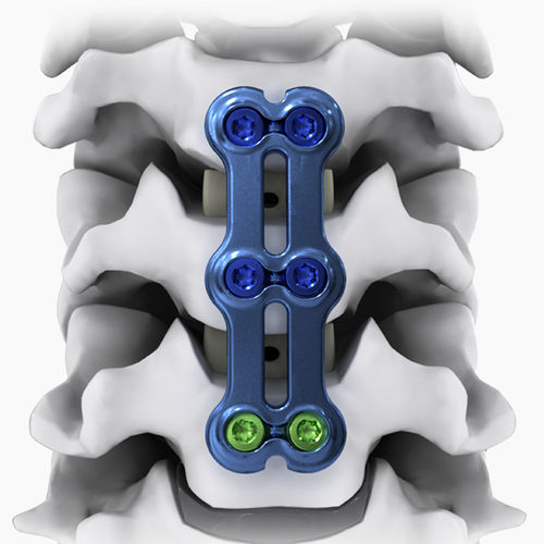 Placa de artrodesis cervical - NEO®-SL - Life Spine - bloqueada / metálica / 2 niveles