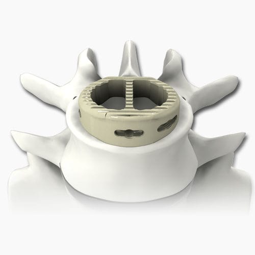Caja intersomática lumbar - PLATEAU®-A - Life Spine - vía anterior / de PEEK