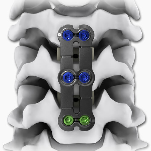 Placa de artrodesis cervical - KINETIC®-SL - Life Spine - bloqueada / metálica / 2 niveles