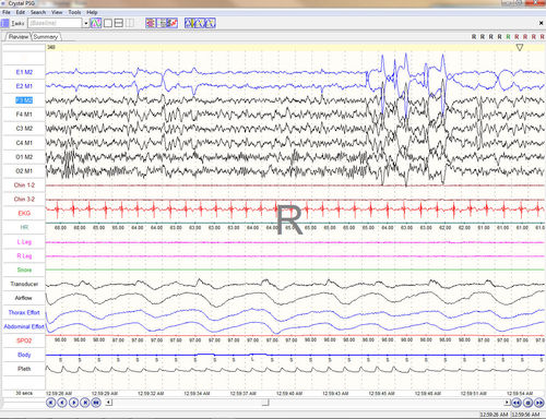 Software de gestión - Crystal PSG™ - CleveMed - para informes / de adquisición / de registro