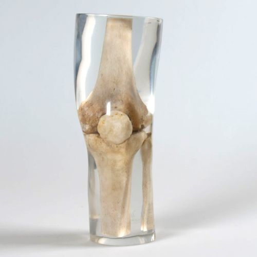 Fantoma de prueba para radiología - 12714 - QUART X-Ray QA Solutions - para pierna / de rodilla / de fémur