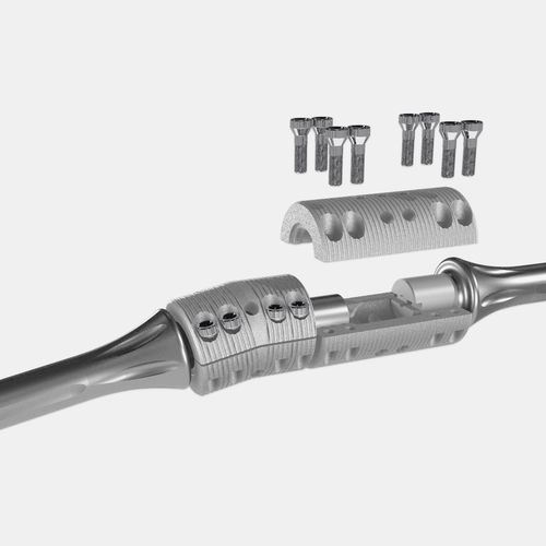 Clavo intramedular para fémur - OsteoBridge™ - Merete - para tibia / para húmero / de titanio