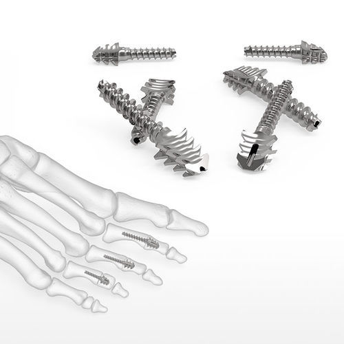 Tornillo de compresión ósea para articulación metatarsofalángica - ExtremiFuse™  - Acumed - metálico