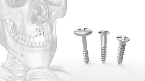 Kit de instrumentos para implantología ósea -  Mincro™ - Acumed