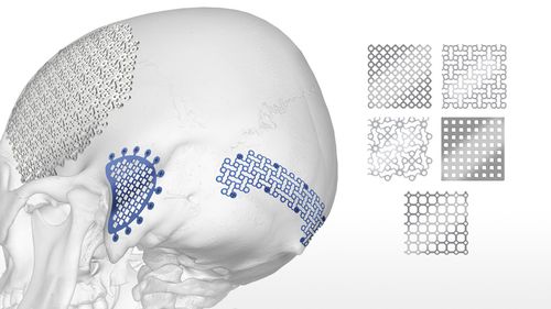 Implante craneal - OsteoForm ™ - Acumed