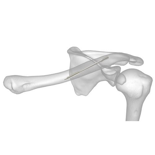 Tornillo de compresión ósea para clavícula - Dual-Trak - Acumed - sin cabeza / metálico