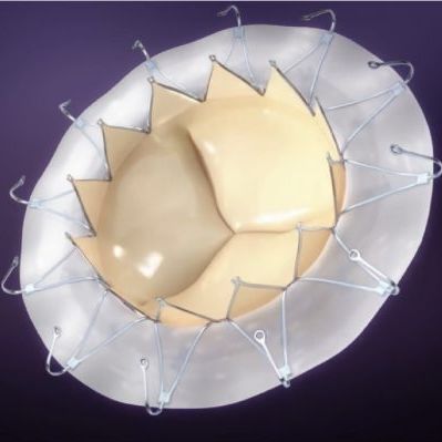 Bioprótesis valvular mitral - AccuFit® - SINOMED