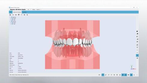 Software de CAD - Studio - AGE Solutions - de visualización 3D / ortodóntico / de laboratorio dental