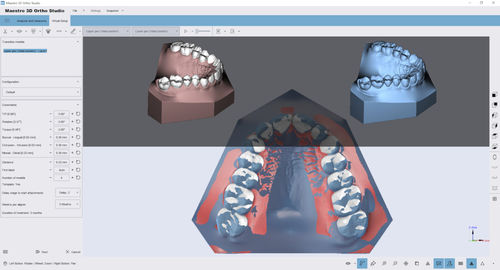 Software de análisis - Ortho Studio - AGE Solutions - de visualización 3D / de medición / de tratamiento