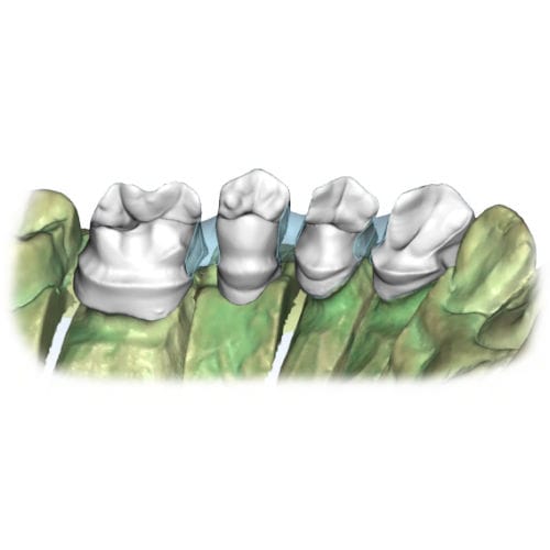 Software para odontología - Restoration - AGE Solutions - de laboratorio / de formación / de CAD