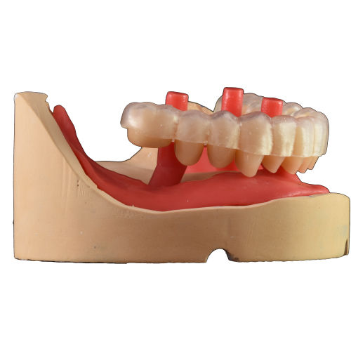 Software para odontología - Smile Creator - AGE Solutions - de captura