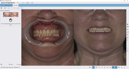 Software para odontología - Digital Mockup - AGE Solutions - de diagnóstico / de tratamiento
