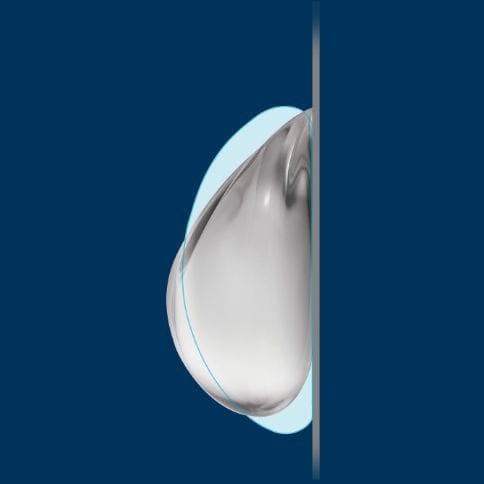 Implante mamario - TruForm® 1 - Allergan - Natrelle - redondo / de silicona / de gel de silicona