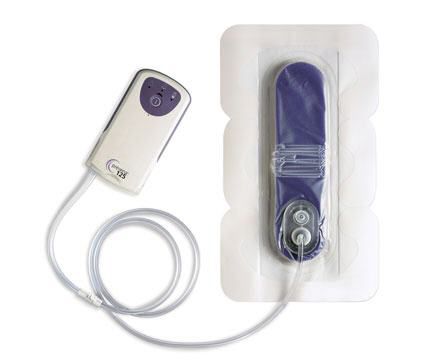 Sistema de terapia de presión negativa para heridas con batería - Prevena™ - Kinetic Concepts