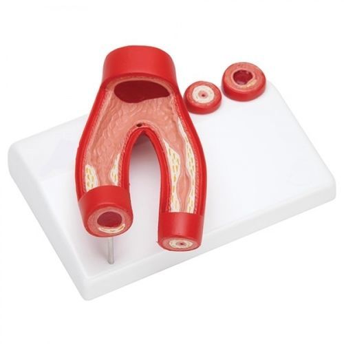 Modelo anatómico de arteria - ZKJ-680-A - Educational + Scientific Products Ltd