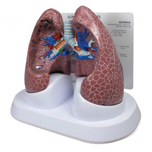 Modelo anatómico de pulmón - 3110 - GPI Anatomicals - de formación / para el cáncer / BPCO