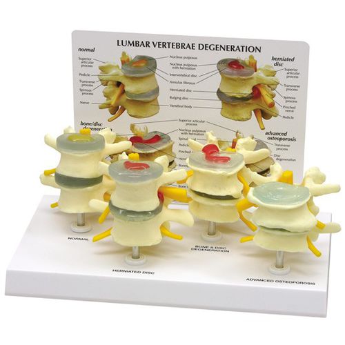 Modelo anatómico de discos intervertebrales - 1760 - GPI Anatomicals - de hueso / de formación / de osteoporosis