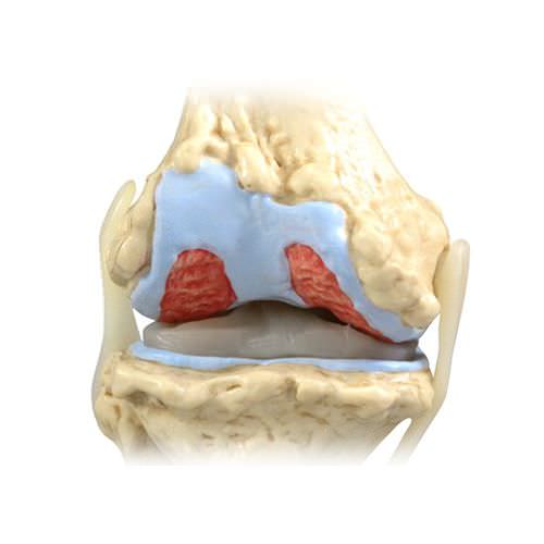 Modelo anatómico de articulación - 1100 - GPI Anatomicals - de rodilla / de formación