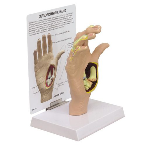Modelo anatómico de hueso - 1930 - GPI Anatomicals - de articulación / de mano / de formación
