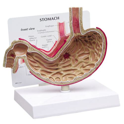 Modelo anatómico de estómago - 2000 - GPI Anatomicals - duodenal / esofágico / de formación