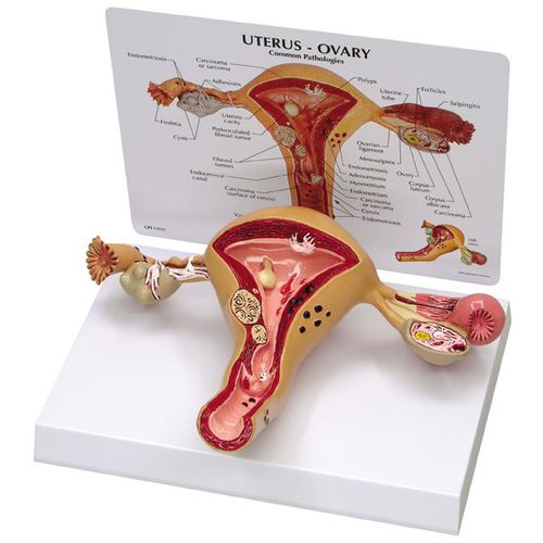 Modelo anatómico de útero - 3480 - GPI Anatomicals - de ovario / de formación / femenino