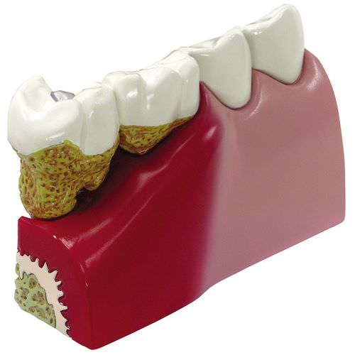 Modelo anatómico de dientes - 2860 - GPI Anatomicals - para odontología / de formación