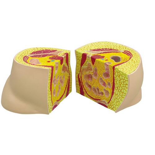 Modelo anatómico de cadera - 3600 - GPI Anatomicals - de formación / para obesidad / bariátrico