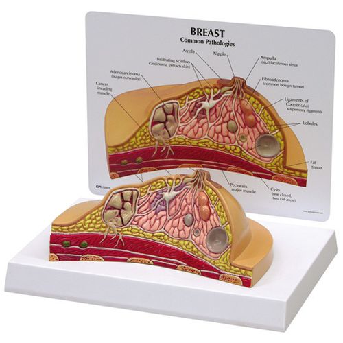 Modelo anatómico de mama - 3450 - GPI Anatomicals - de formación / para el cáncer / femenino