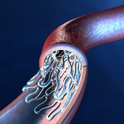 Stent arteria coronaria - CCFlex - eucatech - de cromo cobalto / sin recubrir