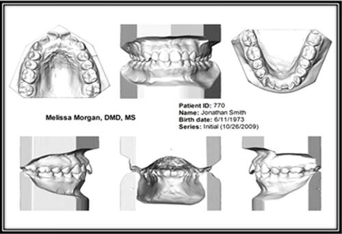 Software de creación de prótesis dentales - Ortho Insight 3D Full / Lite - Motion View Software - de CAD / de visualización 3D / de laboratorio dental