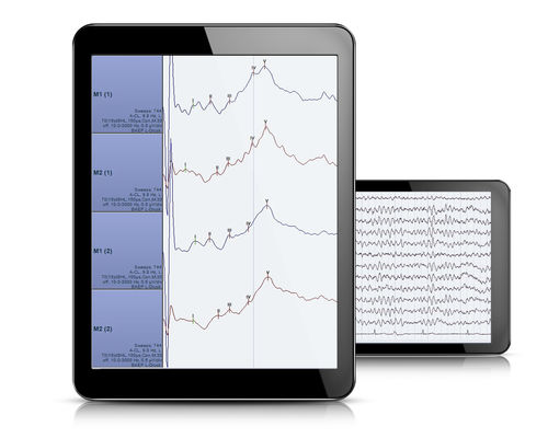 Software de análisis - AlphaView - Dr. Grossegger & Drbal alpha trace medical systems - para EEG / para polisomnografía / Windows