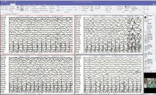 Software de gestión de datos - Profusion™ - Dr. Grossegger & Drbal alpha trace medical systems - de monitorización / de registro / de prueba