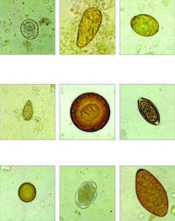 Reactivo colorante - Apacor Ltd. - de parasitología