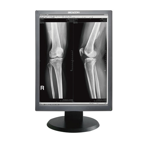 Monitor médico - G23S+ - Shenzhen Beacon Display Technology - de diagnóstico / de alta definición / 21.3"