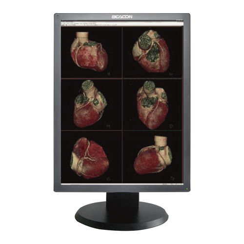 Monitor médico - C310S - Shenzhen Beacon Display Technology - para imágenes médicas / de diagnóstico / de alta definición